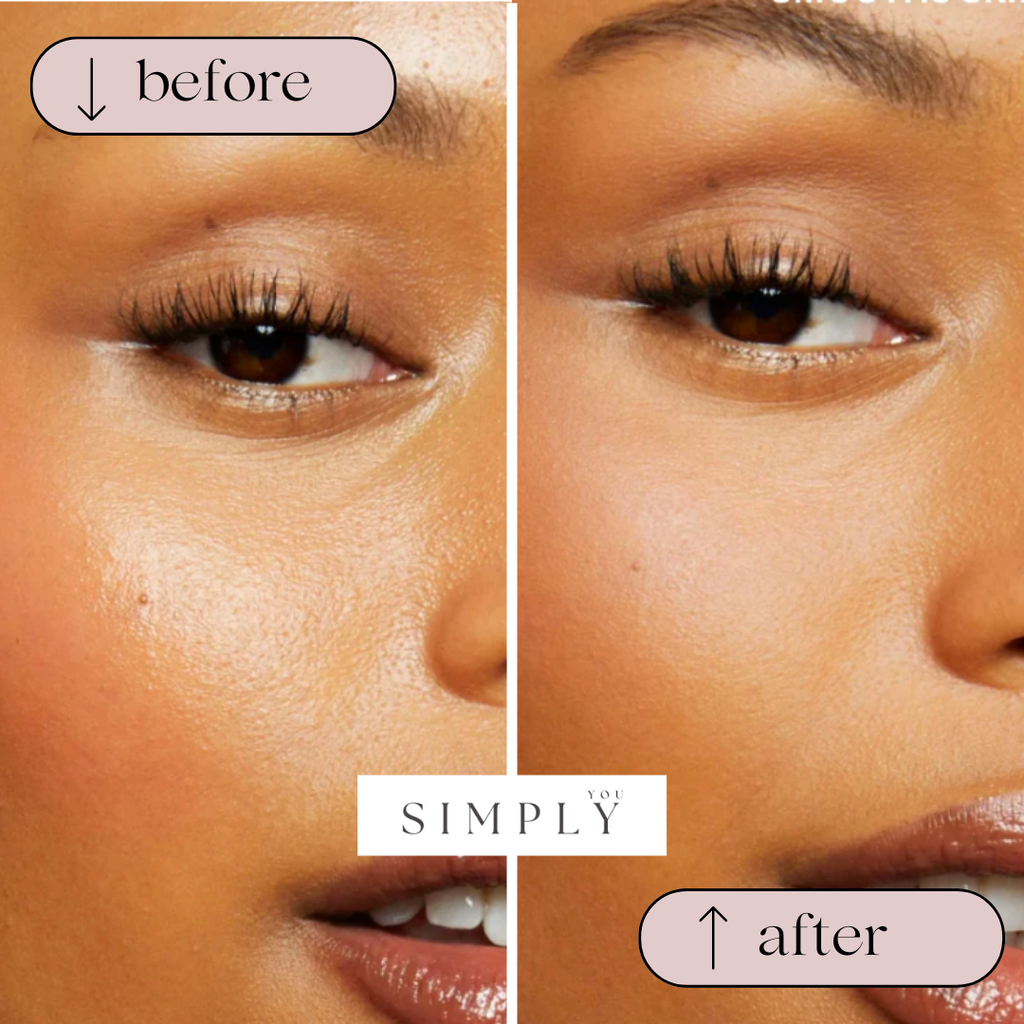 Simply's Oil Absorbing Roller